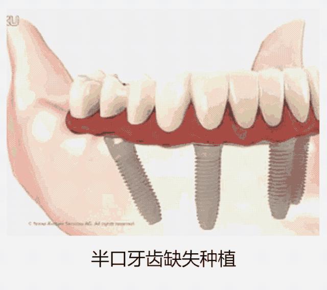 健康元公司最新动态，引领健康产业新风潮